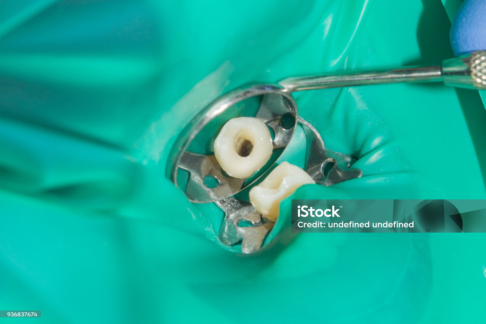 Tish nervini davolash